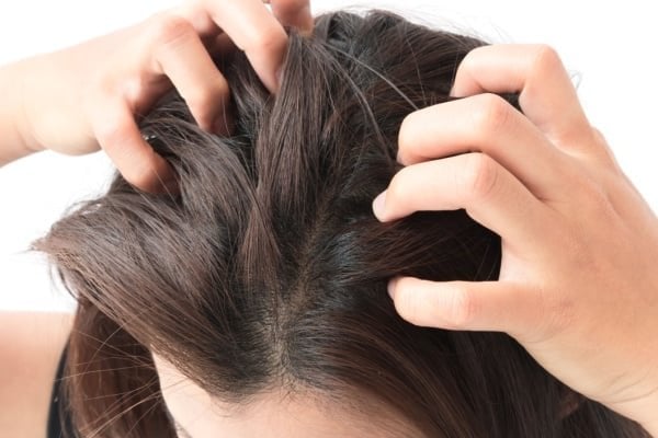 Scalp Discomfort