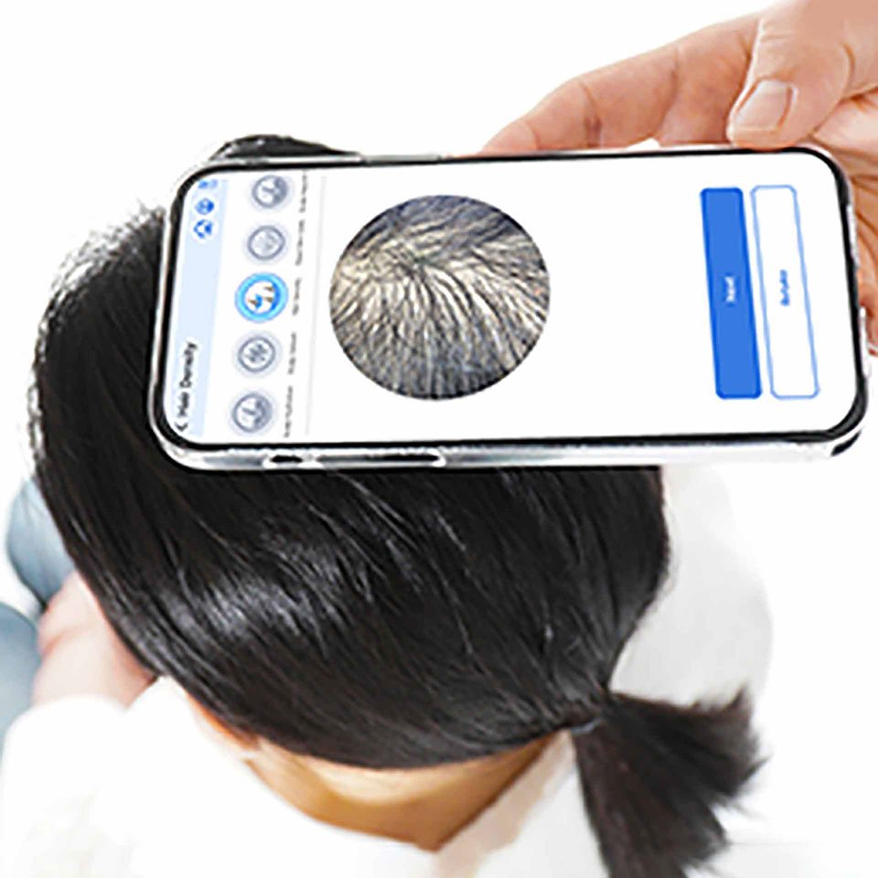 My scalp id