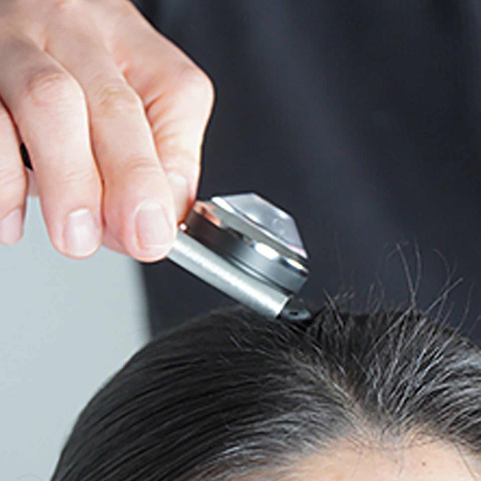 Scalp concern